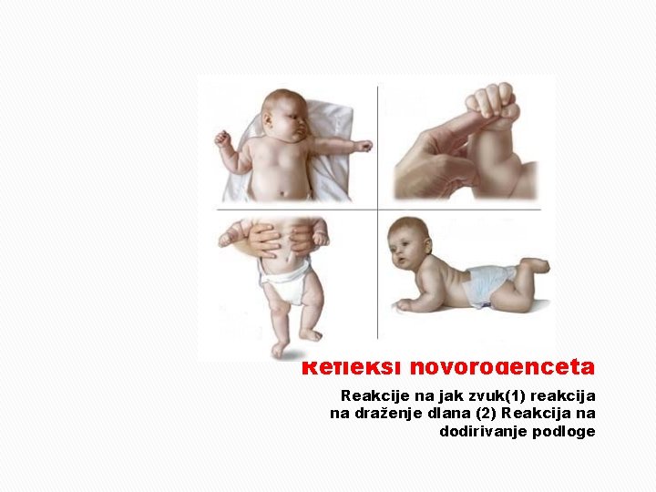 Refleksi novorođenceta Reakcije na jak zvuk(1) reakcija na draženje dlana (2) Reakcija na dodirivanje