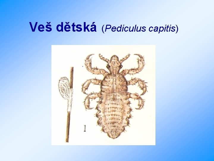 Veš dětská (Pediculus capitis) 