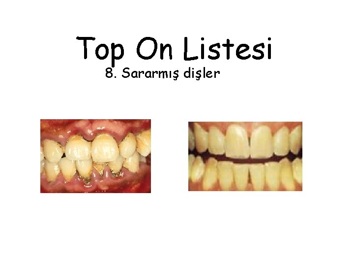 Top On Listesi 8. Sararmış dişler 