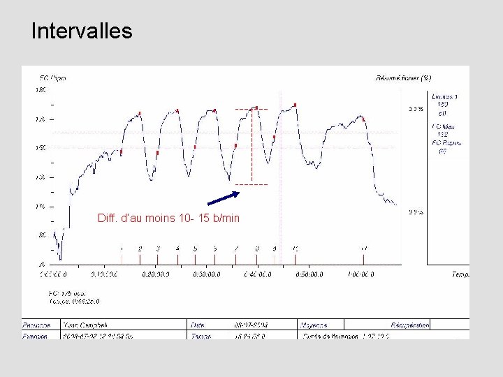 Intervalles Diff. d’au moins 10 - 15 b/min 