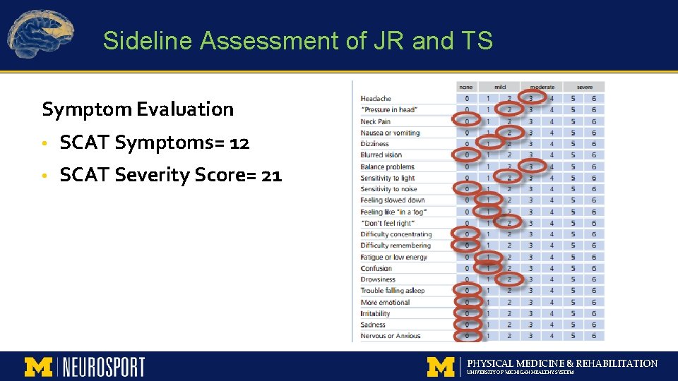 Sideline Assessment of JR and TS Symptom Evaluation • SCAT Symptoms= 12 • SCAT