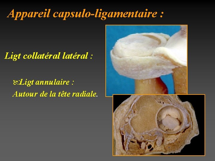 Appareil capsulo-ligamentaire : Ligt collatéral : Ligt annulaire : Autour de la tête radiale.