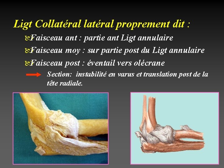 Ligt Collatéral proprement dit : Faisceau ant : partie ant Ligt annulaire Faisceau moy