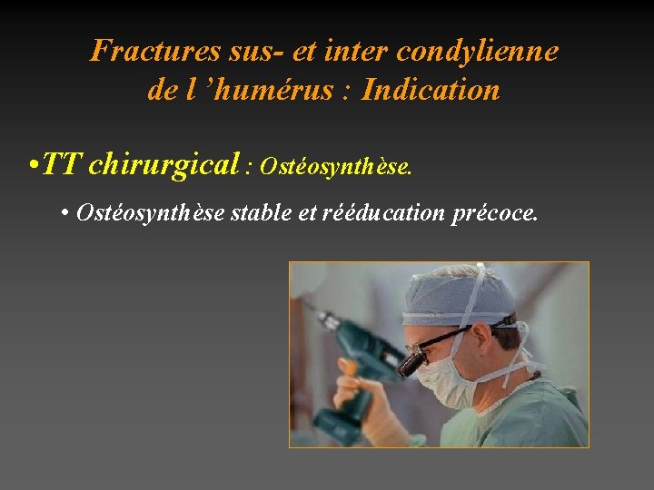 Fractures sus- et inter condylienne de l ’humérus : Indication • TT chirurgical :