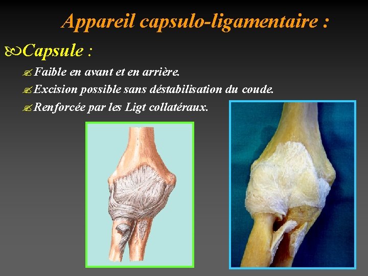 Appareil capsulo-ligamentaire : Capsule : ? Faible en avant et en arrière. ? Excision