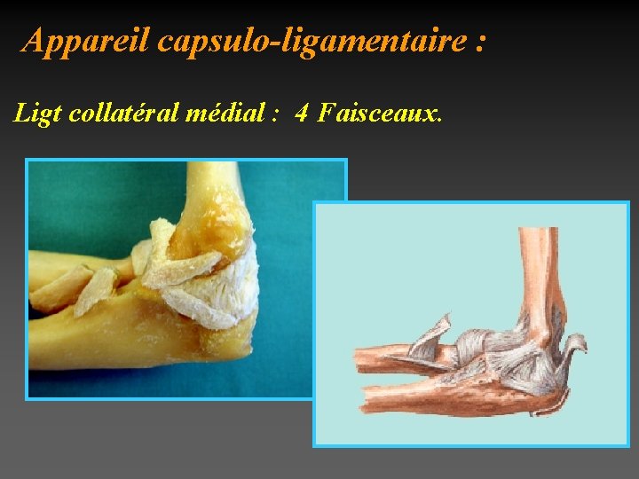 Appareil capsulo-ligamentaire : Ligt collatéral médial : 4 Faisceaux. 