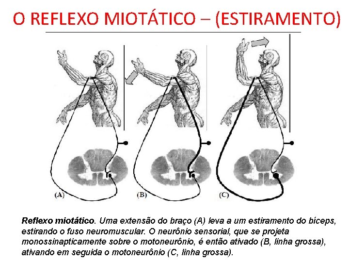 O REFLEXO MIOTÁTICO – (ESTIRAMENTO) Reflexo miotático. Uma extensão do braço (A) leva a