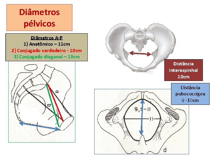 Diâmetros pélvicos Diâmetros A-P Avaliação da 1) Anatômico – 11 cm proporção céfalo-- 10