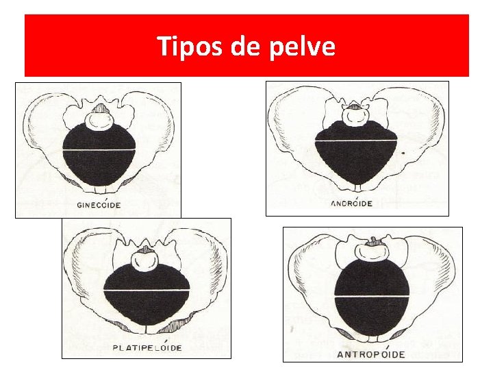 Tipos de pelve 