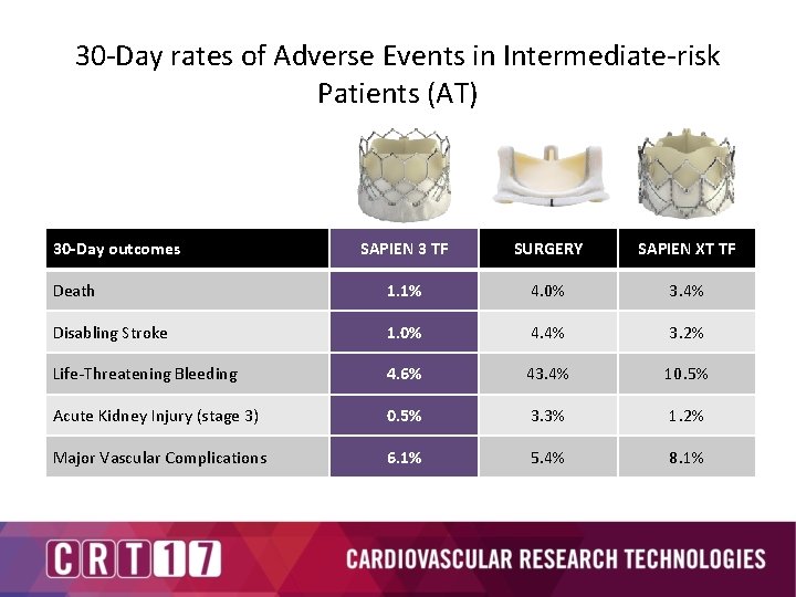 30 -Day rates of Adverse Events in Intermediate-risk Patients (AT) 30 -Day outcomes SAPIEN