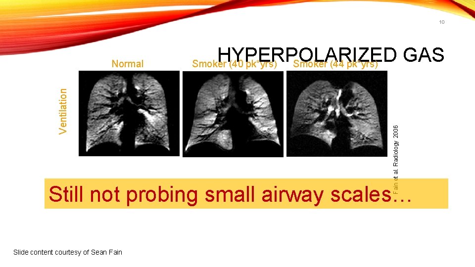 10 HYPERPOLARIZED GAS Smoker (44 pk*yrs) Smoker (40 pk*yrs) Fain et al. Radiology 2006