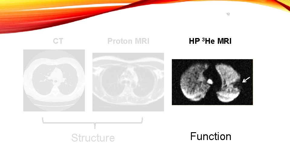 12 CT Proton MRI Structure HP 3 He MRI Function 