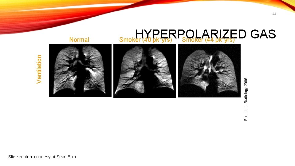 22 HYPERPOLARIZED GAS Smoker (44 pk*yrs) Smoker (40 pk*yrs) Slide content courtesy of Sean