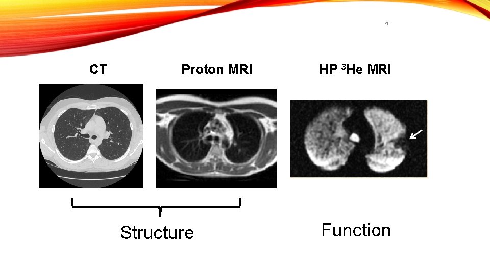 4 CT Proton MRI Structure HP 3 He MRI Function 