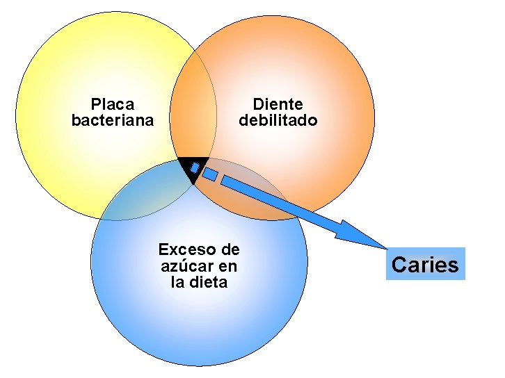 Placa bacteriana Diente debilitado Exceso de azúcar en la dieta Caries 