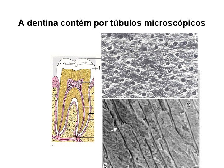 A dentina contém por túbulos microscópicos 