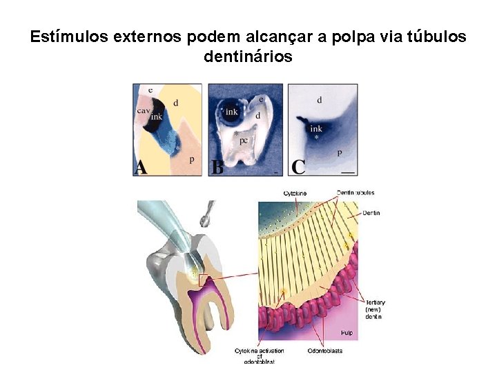 Estímulos externos podem alcançar a polpa via túbulos dentinários 