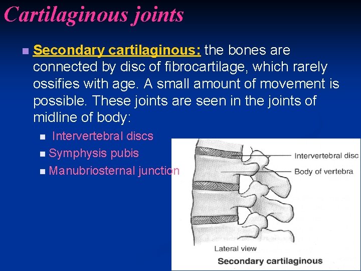 Cartilaginous joints n Secondary cartilaginous: the bones are connected by disc of fibrocartilage, which