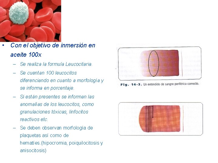 • Con el objetivo de inmersión en aceite 100 x – Se realiza • Con el objetivo de inmersión en aceite 100 x – Se realiza