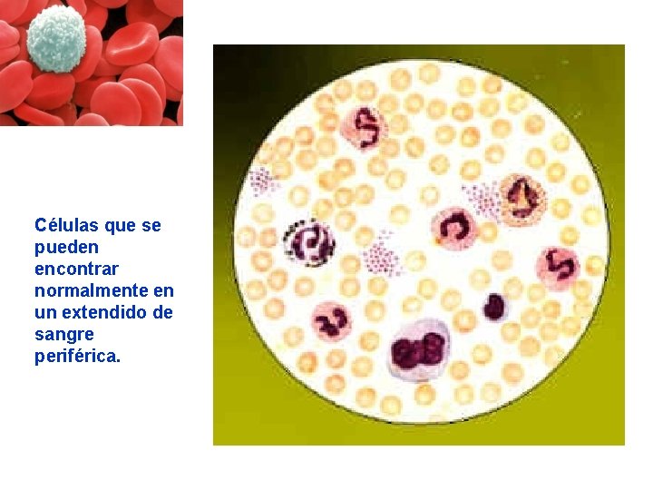 Células que se pueden encontrar normalmente en un extendido de sangre periférica. Células que se pueden encontrar normalmente en un extendido de sangre periférica.
