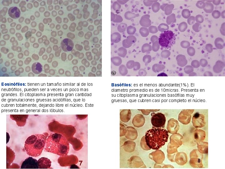 Eosinófilos: tienen un tamaño similar al de los neutrófilos, pueden ser a veces un Eosinófilos: tienen un tamaño similar al de los neutrófilos, pueden ser a veces un