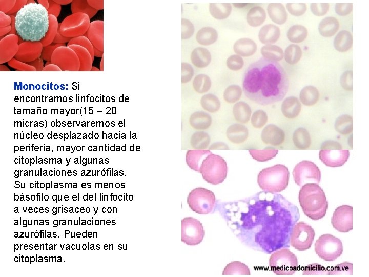Monocitos: Si encontramos linfocitos de tamaño mayor(15 – 20 micras) observaremos el núcleo desplazado Monocitos: Si encontramos linfocitos de tamaño mayor(15 – 20 micras) observaremos el núcleo desplazado