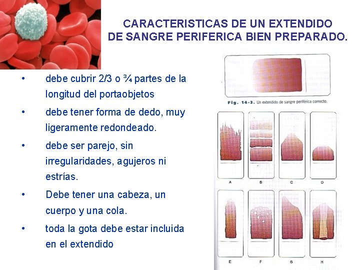 CARACTERISTICAS DE UN EXTENDIDO DE SANGRE PERIFERICA BIEN PREPARADO. • debe cubrir 2/3 o CARACTERISTICAS DE UN EXTENDIDO DE SANGRE PERIFERICA BIEN PREPARADO. • debe cubrir 2/3 o