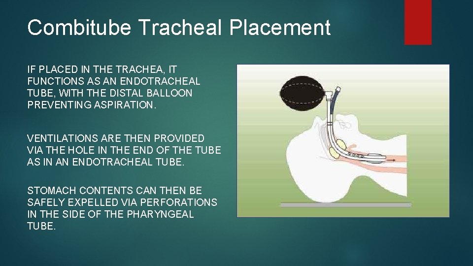 Combitube Tracheal Placement IF PLACED IN THE TRACHEA, IT FUNCTIONS AS AN ENDOTRACHEAL TUBE, Combitube Tracheal Placement IF PLACED IN THE TRACHEA, IT FUNCTIONS AS AN ENDOTRACHEAL TUBE,
