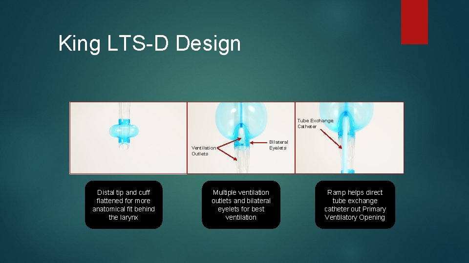 King LTS-D Design Tube Exchange Catheter Ventilation Outlets Distal tip and cuff flattened for King LTS-D Design Tube Exchange Catheter Ventilation Outlets Distal tip and cuff flattened for