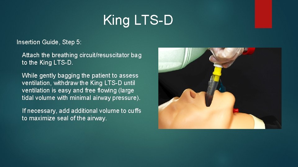 King LTS-D Insertion Guide, Step 5: Attach the breathing circuit/resuscitator bag to the King King LTS-D Insertion Guide, Step 5: Attach the breathing circuit/resuscitator bag to the King