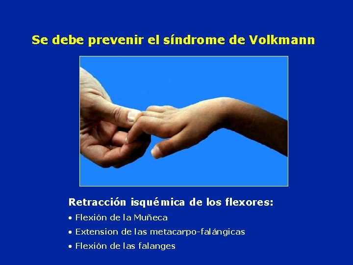 Se debe prevenir el síndrome de Volkmann Retracción isquémica de los flexores: • Flexión