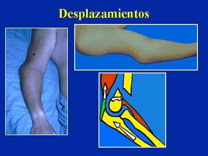 Desplazamientos 