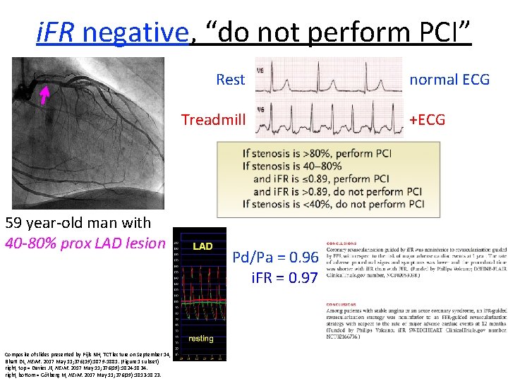 i. FR negative, “do not perform PCI” Rest Treadmill 59 year-old man with 40