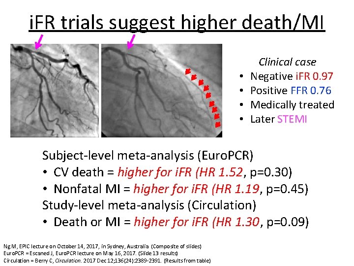 i. FR trials suggest higher death/MI • • Clinical case Negative i. FR 0.