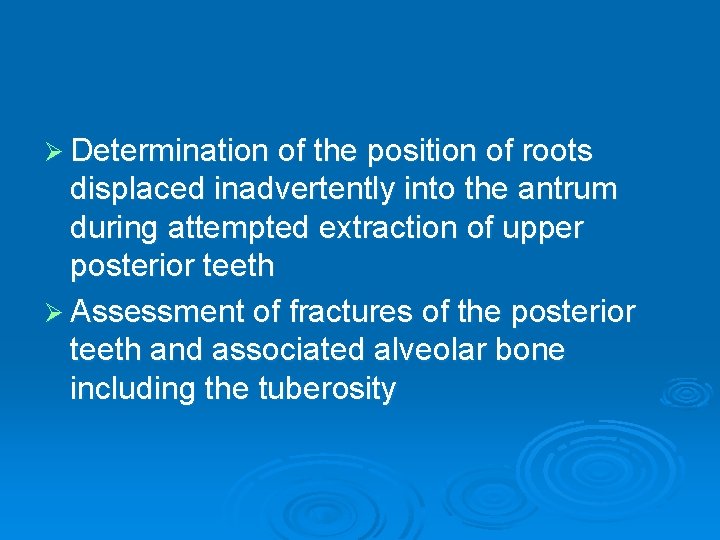 Ø Determination of the position of roots displaced inadvertently into the antrum during attempted