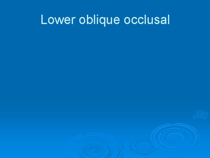 Lower oblique occlusal 