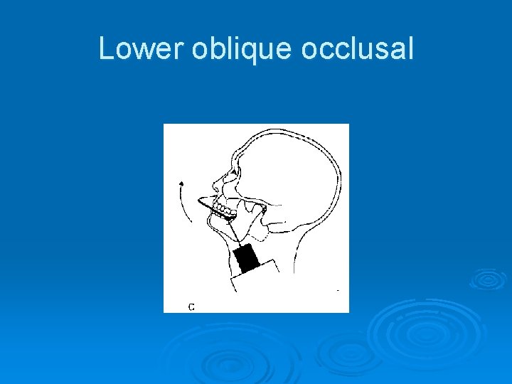 Lower oblique occlusal 