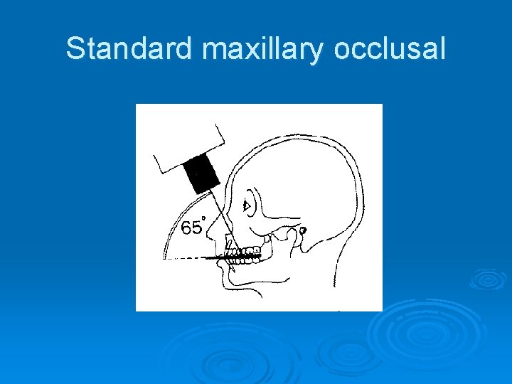 Standard maxillary occlusal 