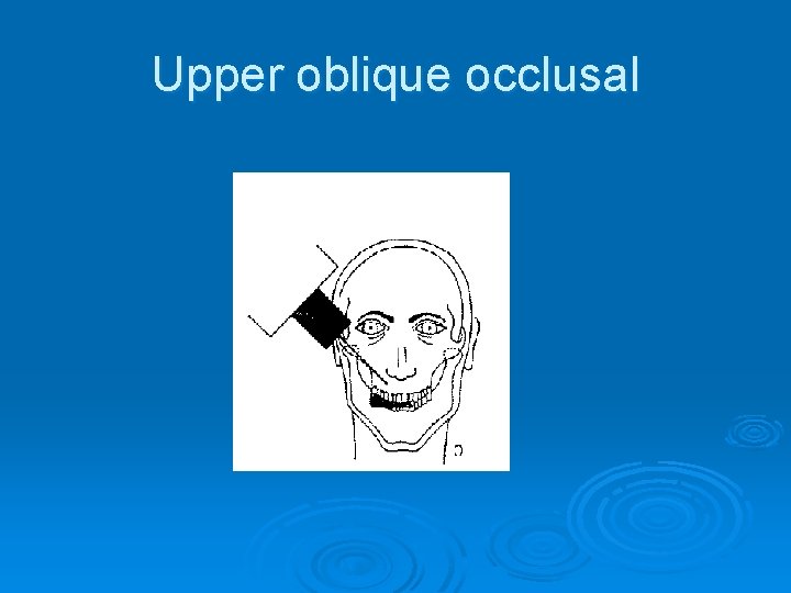 Upper oblique occlusal 