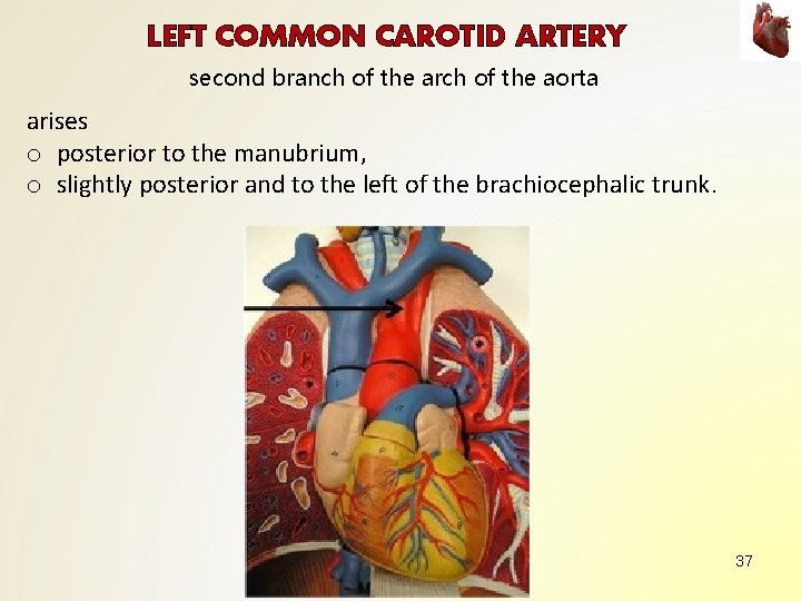 LEFT COMMON CAROTID ARTERY second branch of the arch of the aorta arises o LEFT COMMON CAROTID ARTERY second branch of the arch of the aorta arises o