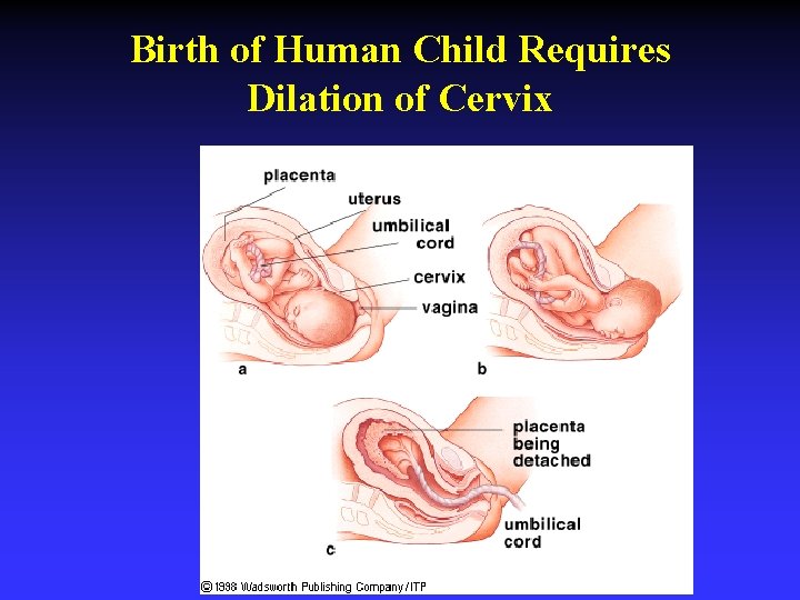 Birth of Human Child Requires Dilation of Cervix 