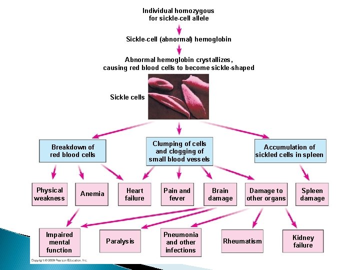 Individual homozygous for sickle-cell allele Sickle-cell (abnormal) hemoglobin Abnormal hemoglobin crystallizes, causing red blood