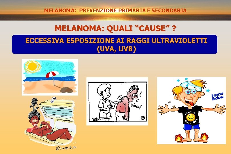 MELANOMA: PREVENZIONE PRIMARIA E SECONDARIA MELANOMA: QUALI “CAUSE” ? ECCESSIVA ESPOSIZIONE AI RAGGI ULTRAVIOLETTI