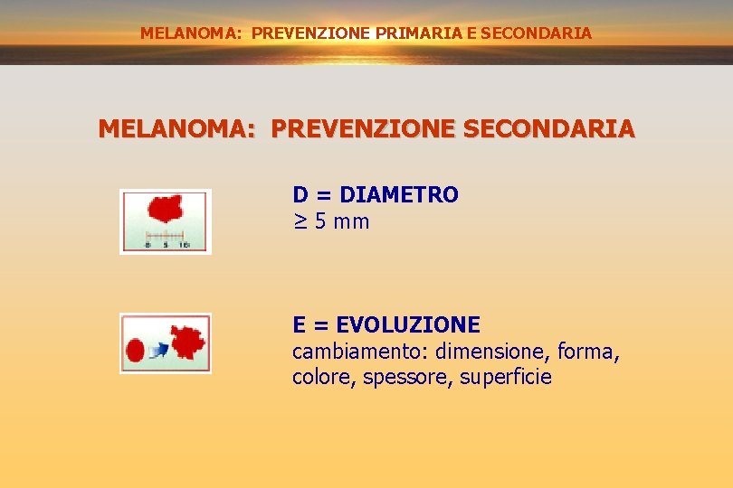 MELANOMA: PREVENZIONE SECONDARIA PRIMARIA E SECONDARIA MELANOMA: PREVENZIONE SECONDARIA D = DIAMETRO ≥ 5