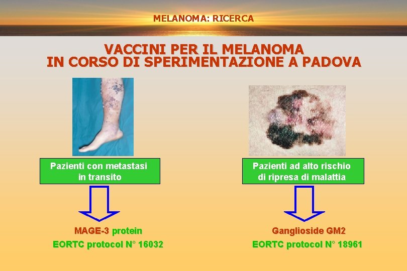 MELANOMA: RICERCA VACCINI PER IL MELANOMA IN CORSO DI SPERIMENTAZIONE A PADOVA Pazienti con