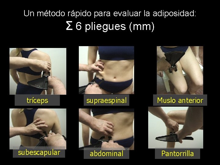 Un método rápido para evaluar la adiposidad: Σ 6 pliegues (mm) tríceps supraespinal subescapular