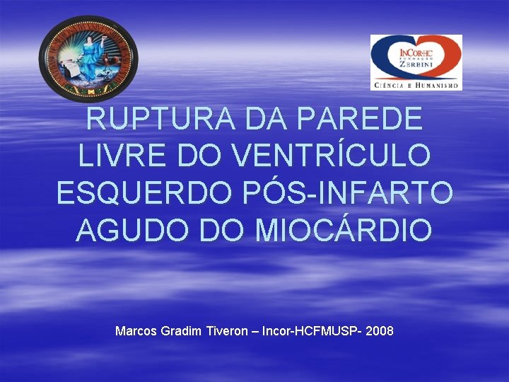 RUPTURA DA PAREDE LIVRE DO VENTRÍCULO ESQUERDO PÓS-INFARTO AGUDO DO MIOCÁRDIO Marcos Gradim Tiveron RUPTURA DA PAREDE LIVRE DO VENTRÍCULO ESQUERDO PÓS-INFARTO AGUDO DO MIOCÁRDIO Marcos Gradim Tiveron