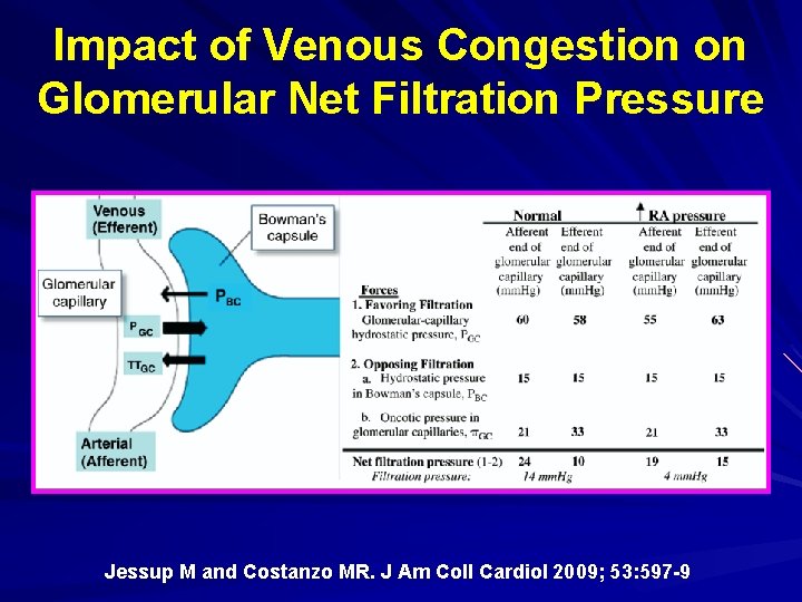 Impact of Venous Congestion on Glomerular Net Filtration Pressure Jessup M and Costanzo MR. Impact of Venous Congestion on Glomerular Net Filtration Pressure Jessup M and Costanzo MR.