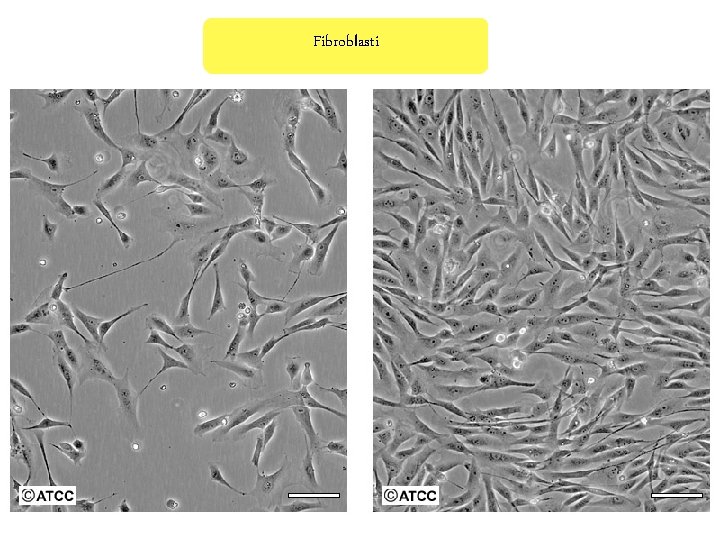Fibroblasti 