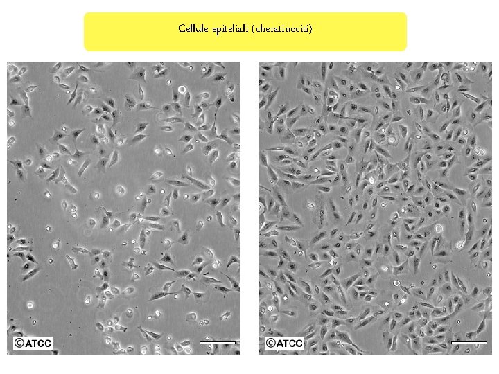 Cellule epiteliali (cheratinociti) 